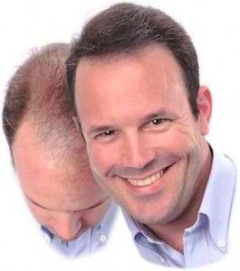 hair photo:best hair loss treatment for women 