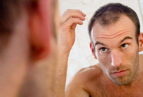 hair photo:he shou wu hair loss 
